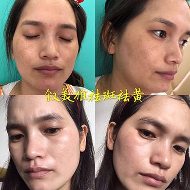 案例对比