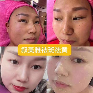 案例对比