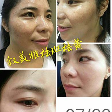 案例对比