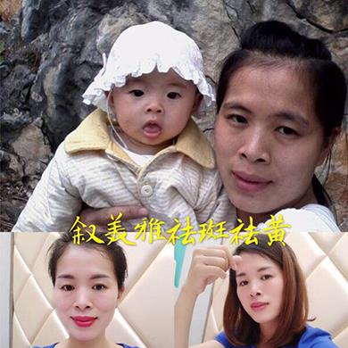 案例对比