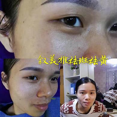 案例对比