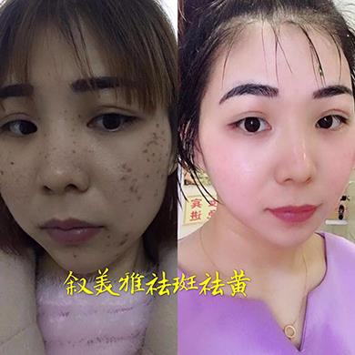 案例对比
