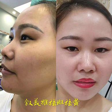 案例对比