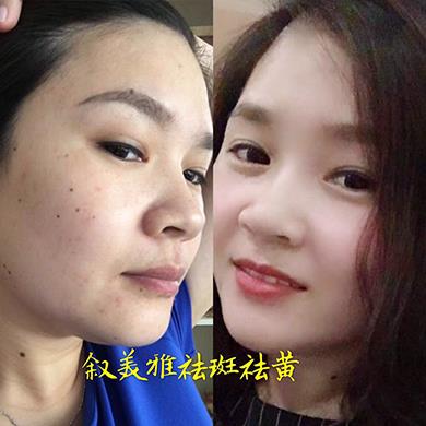 案例对比