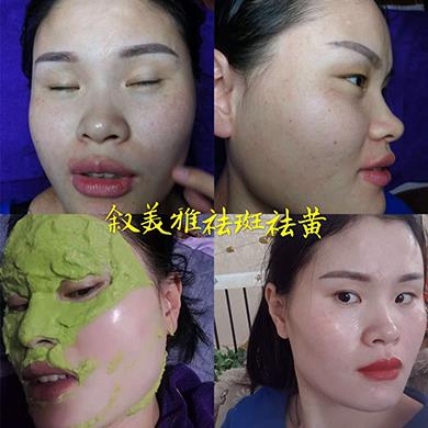 案例对比