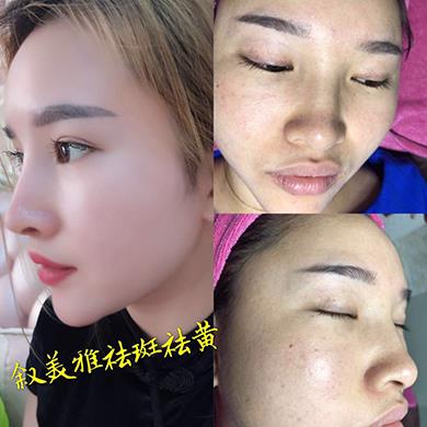 案例对比